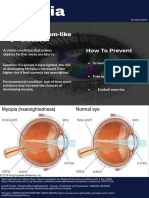 Eye Disease Poster - Myopia