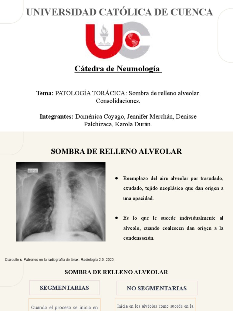 Consolidaciones PDF Pulmón Neumonía