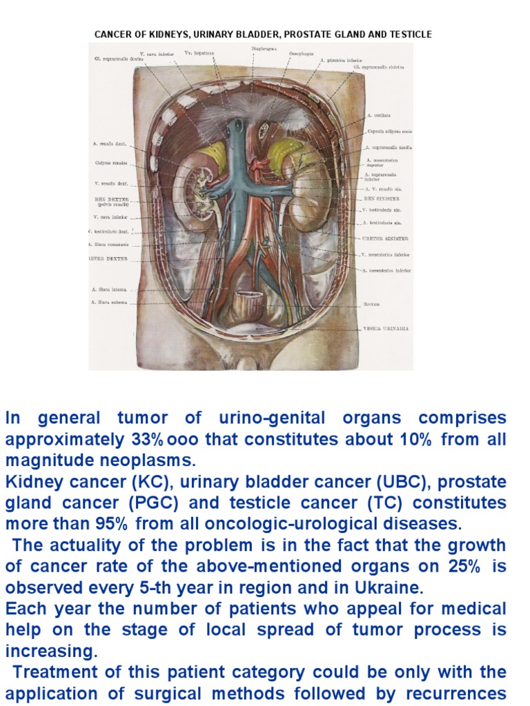 Kidneys, UB, prostate, testicles PDF Prostate Cancer Cancer