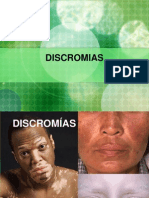 Discromías: causas y clasificación de las alteraciones de la pigmentación