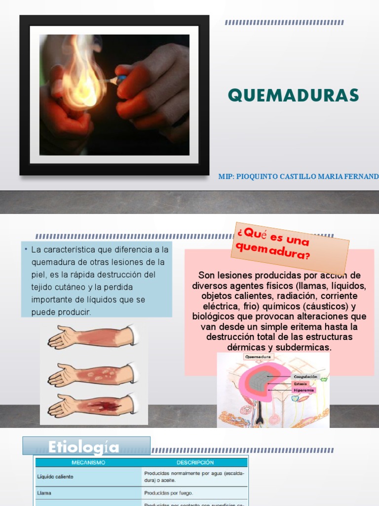 Clasificación y Manejo de Quemaduras | PDF | Quemar | Herida