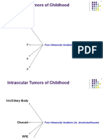 Intraocular Tumors of Childhood: Four Intraocular Locations (Ie, Structures/tissues)