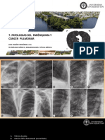 Patologias Del Parénquima Y Cáncer Pulmonar