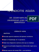 Apendicitis Aguda