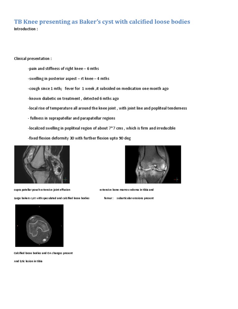 TB Knee Presenting As Baker | PDF | Cooking, Food & Wine