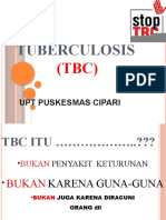 Tuberculosis: Upt Puskesmas Cipari