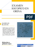 Examen Microcopico en Orina