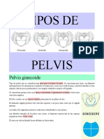 Tipos de Pelvis