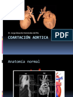 Coartación Aortica 1