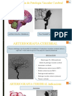 Arteriografia Cerebral Tractament Aneurisma