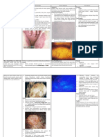 RANGKUMAN Tinea or Pityriasis