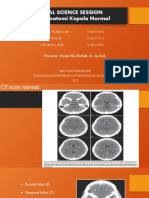 Clinical Science Session CT Scan Anatomi Kepala Normal: Preceptor: Dyana Eka Hadiati, DR., SP - Rad