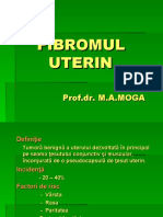 Fibromul Uterin