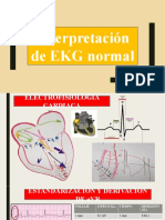 Interpretación de EKG Normal