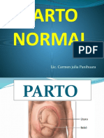 Parto Normal: Lic. Carmen Julia Panihuara