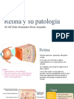 Retina y sus patologías más comunes