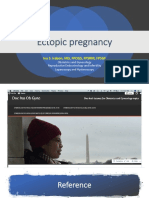 Ectopic Pregnancy