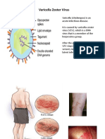 Varicella Zoster Virus