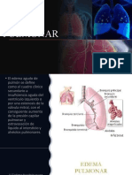 Edema Pulmonar