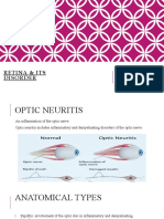 Retina & Its Disorder