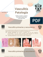 Vasculitis