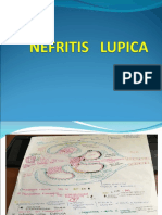 Glomerulonefritis tipos causas