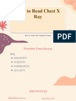 How To Read Chest X Ray: Here Is Where This Template Begins