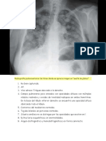 Radiografía de Tórax