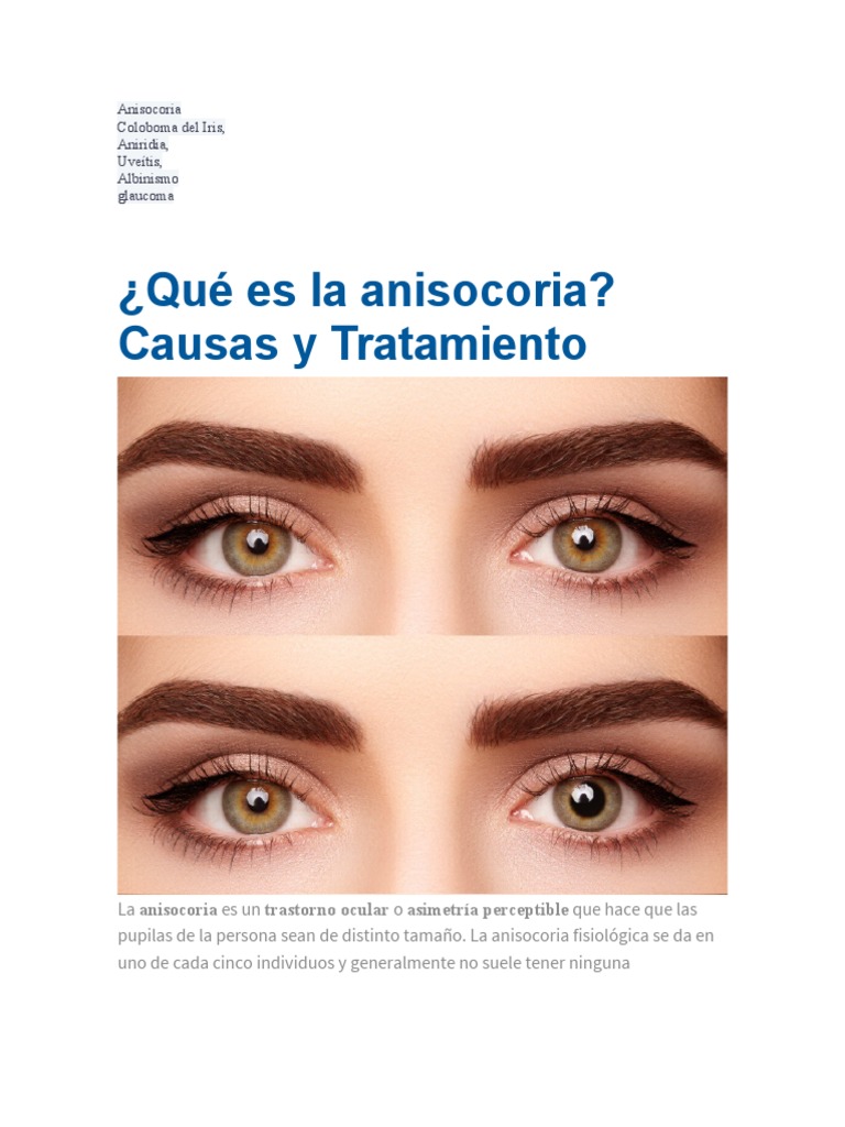 Causas, síntomas y tratamiento de la anisocoria y otras patologías