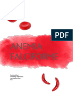 Anemia Falciforme