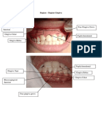 Mucocogingival Junction Free Gingiva Grove