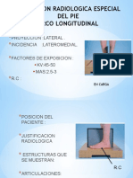 Radiografía lateral del pie