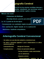 Angiografia Cerebral