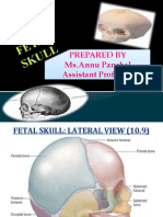 Fetal Skull