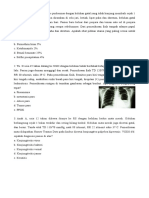 Konjungtivitis virus pada anak