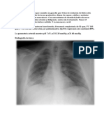 Neumonía por COVID-19 en hombre de 44 años con factores de riesgo