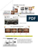 La Esté: PERIODONTITIS - Dr. David Castillo Qué Es La Periodontitis?