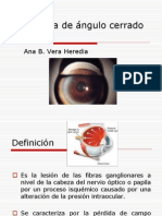Glaucoma de Ngulo Cerrado y Abierto