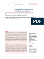 Linfedema Verrugoso (Elefantiasis Verrugosa Nostra) Secundario A Regresión de Sarcoma de Kaposi