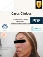 Casos Clínicos: Elizabeth Guevara Sánchez Dermatología