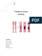 Trombosis venosa profunda: causas, síntomas y tratamiento