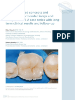 Evidence based concepts for bonded inlays and onlays. PartIII. Case series-Dietschi2019