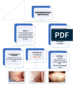 Enfermedades Eruptivas