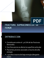 Fractura Supracondilea de Femur