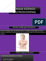 Seriada Esófago-Gastroduodenal: Nadia Monje