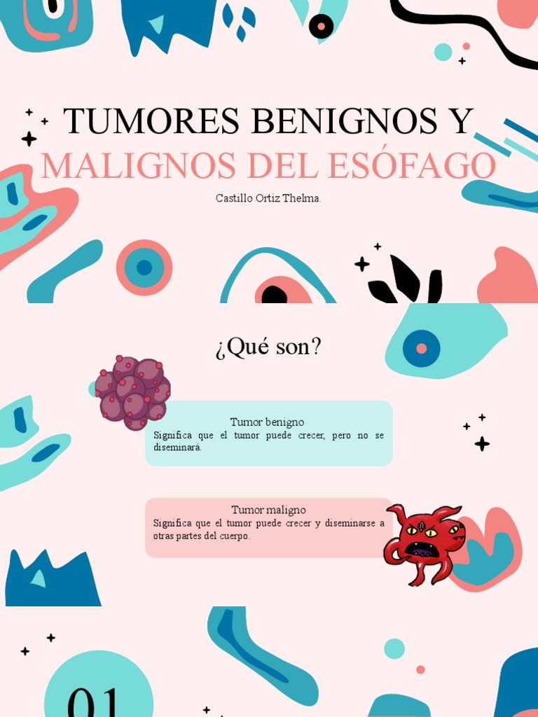 Cancer de Esofago | PDF | Cáncer | Adenocarcinoma