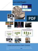 Transcranial Doppler