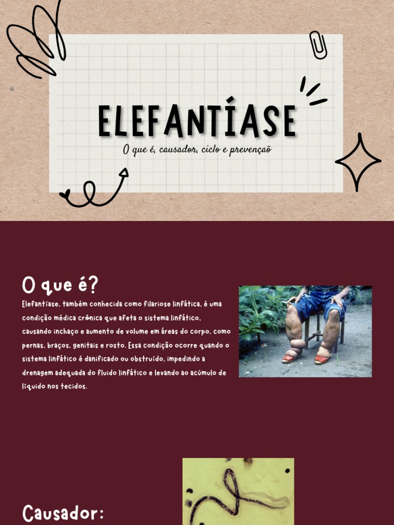 Elefantíase: Causas e Prevenção | PDF | Tecnologia e Engenharia