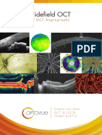 Intl Avanti-AngioVue Brochure PDF