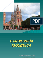 Cardiopatía Isquemica